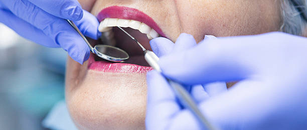 Best Emergency Treatment for Dental Infections or Abscesses in River Forest, IL